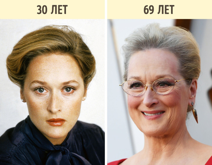 звёзды которые принимают себя такими какие они есть, звёзды против пластики 