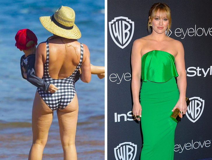 звёзды которые принимают себя такими какие они есть, звёзды против пластики 