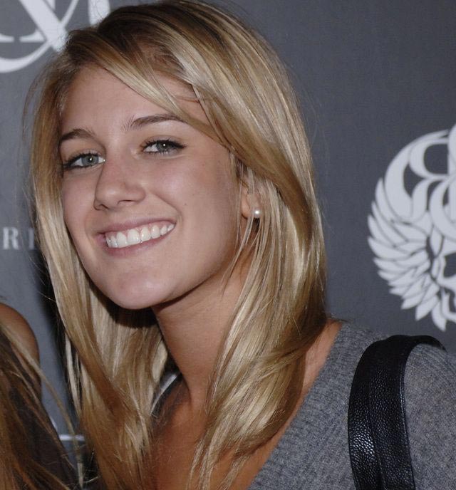 знаменитости до и после пластических операций, звёзды после пластики 