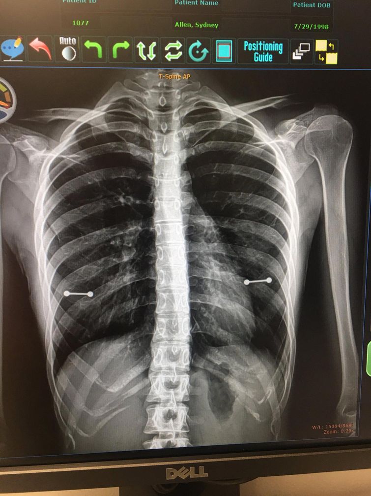 истории о нелепых ситуациях, смешные ситуации читать, неловкие ситуации читать, нелепые ситуации фото