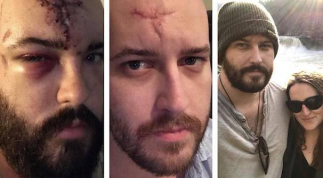 Эти люди бросили пить алкоголь, и вы только взгляните как сильно они изменились люди отказавшиеся от алкоголя, бросили пить до и после, люди до и после того как бросили пить, отказ от алкоголя до и после