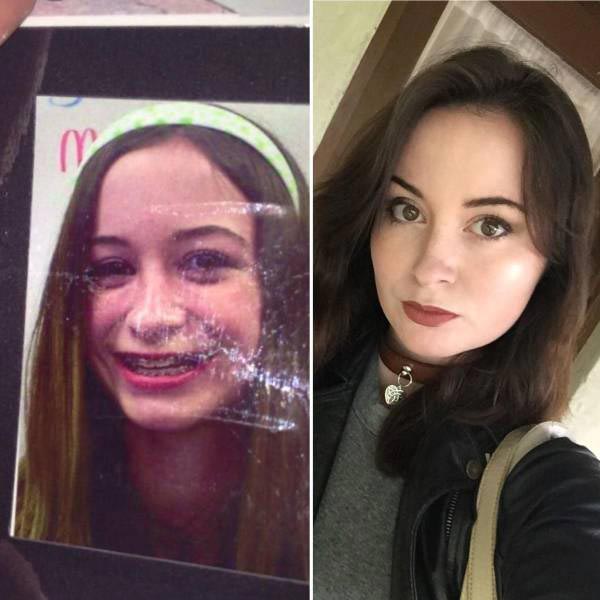 30 несуразных подростков, которые с возрастом превратились в секси-шмекси подростки выросли в красавцев, несуразные подростки в горячих красавцев, подростки изменились с возрастом, люди с возрастом сильно изменились