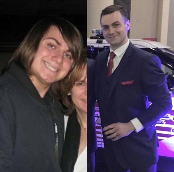 30 несуразных подростков, которые с возрастом превратились в секси-шмекси подростки выросли в красавцев, несуразные подростки в горячих красавцев, подростки изменились с возрастом, люди с возрастом сильно изменились