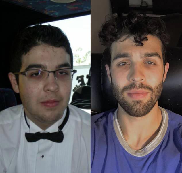 30 несуразных подростков, которые с возрастом превратились в секси-шмекси подростки выросли в красавцев, несуразные подростки в горячих красавцев, подростки изменились с возрастом, люди с возрастом сильно изменились