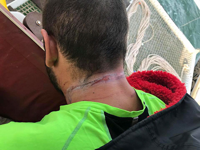 Росс Эджли 5 месяцев плавал вокруг Британии и то, что он перенёс, заставит вас вздрогнуть Росс Эджли 5 месяцев плавал вокруг Британии, Росс Эджли, Ross Edgley, Росс Эджли 2800 км, считается первым человеком который обогнул Великобританию вплавь