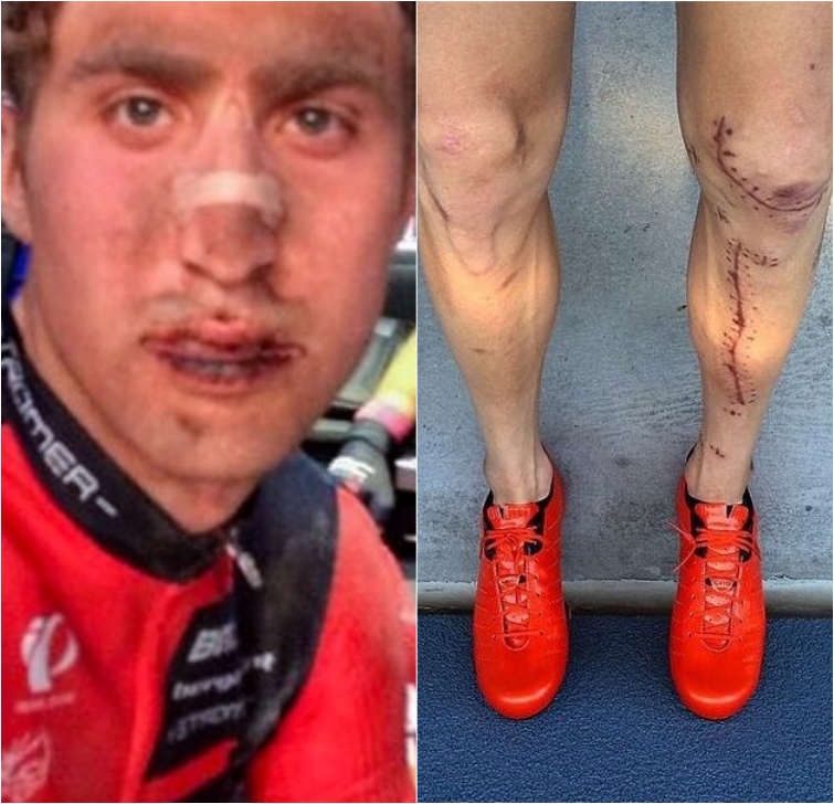 на что идут актёры балерины и футболисты для работы своей мечты, обратная сторона жизни балерин