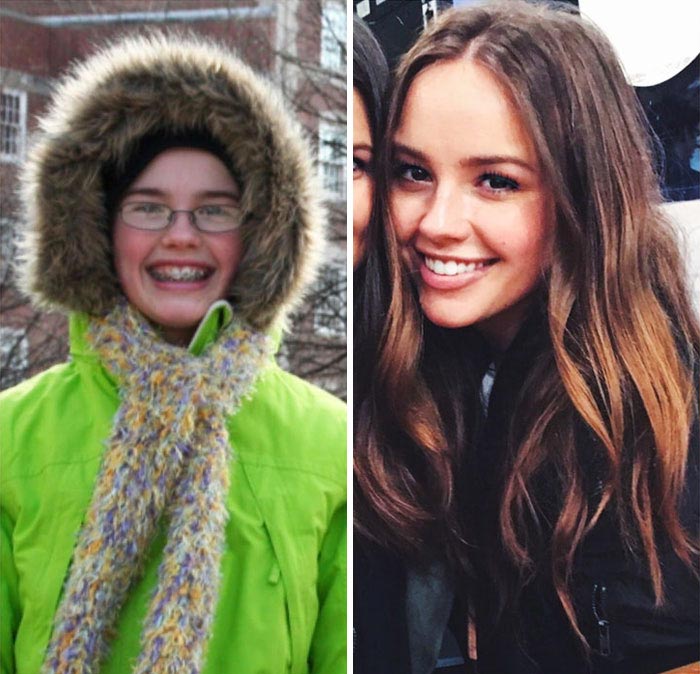 25 'гадких утят' превратившихся в сексуальных красавцев, которые не могут не удивлять преображение гадких утят, бывшие гадкие утята, из гадких утят в красавцев, люди тогда и сейчас