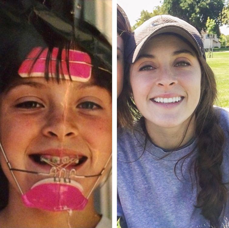 25 'гадких утят' превратившихся в сексуальных красавцев, которые не могут не удивлять преображение гадких утят, бывшие гадкие утята, из гадких утят в красавцев, люди тогда и сейчас