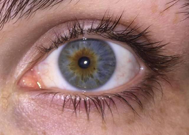 20 людей, чьи тела слишком странные, чтобы быть реальными люди со странными телами, необычные люди, странные люди, люди со странностями