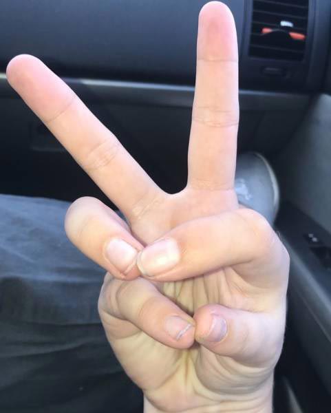 20 людей, чьи тела слишком странные, чтобы быть реальными люди со странными телами, необычные люди, странные люди, люди со странностями