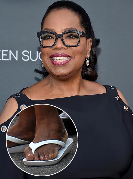 Знаменитости с изъянами тела, недостатки знаменитостей 