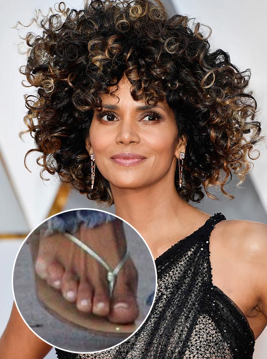 Знаменитости с изъянами тела, недостатки знаменитостей 