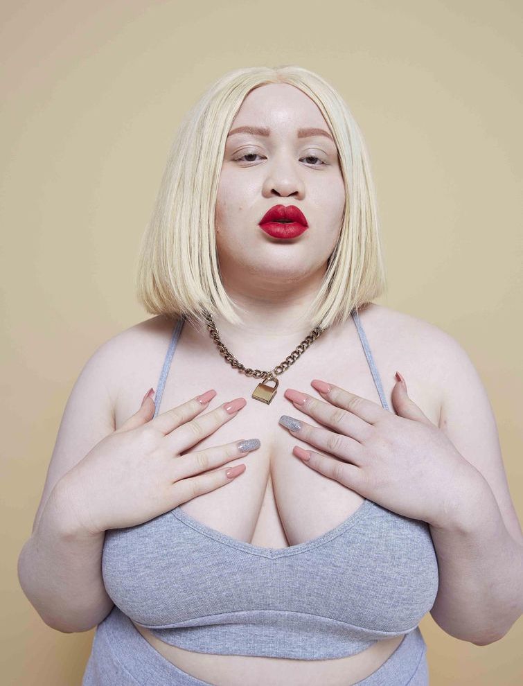 модели с проблемной кожей, модели с проблемами кожи, необычные модели, уникальные модели