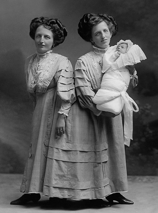 истории о сиамских близнецах, сиамские близнецы у которых все в жизни сложилось хорошо