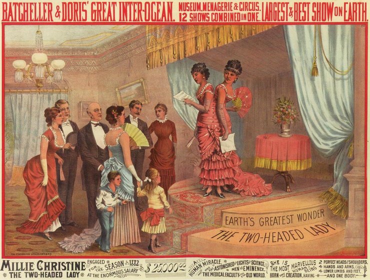 истории о сиамских близнецах, сиамские близнецы у которых все в жизни сложилось хорошо