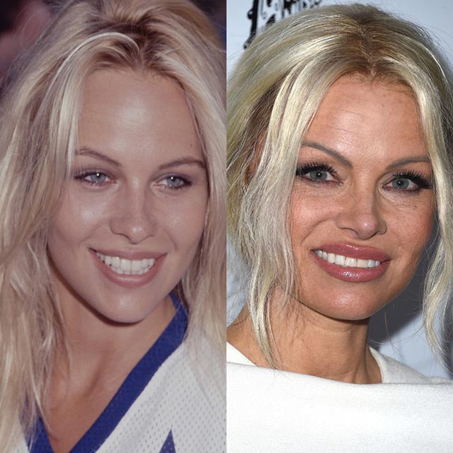 18 голливудских знаменитостей, которых не пощадило время знаменитости которых не пощадило время, звёзды которые не красиво стареют