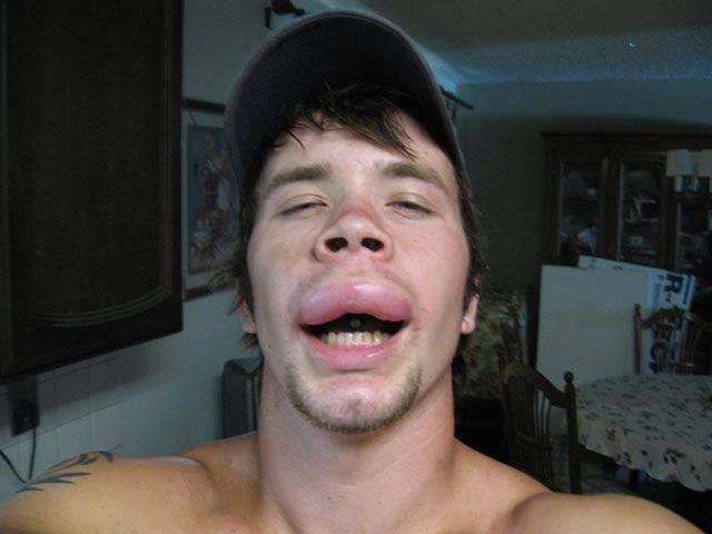 лица людей после аллергии, лица животных после аллергии, люди после аллергической реакции, животные после аллергической реакции