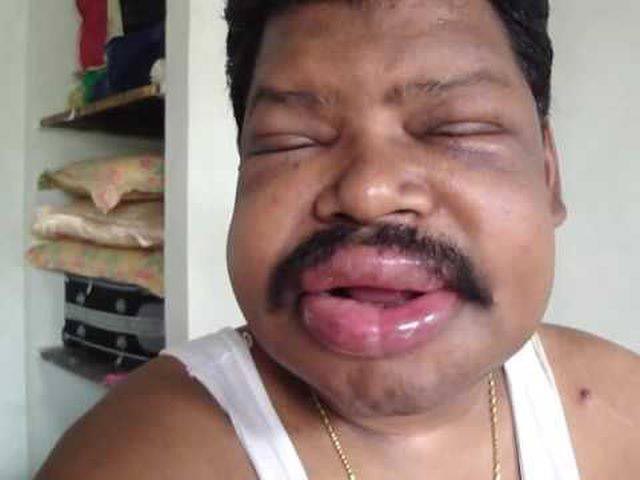 лица людей после аллергии, лица животных после аллергии, люди после аллергической реакции, животные после аллергической реакции