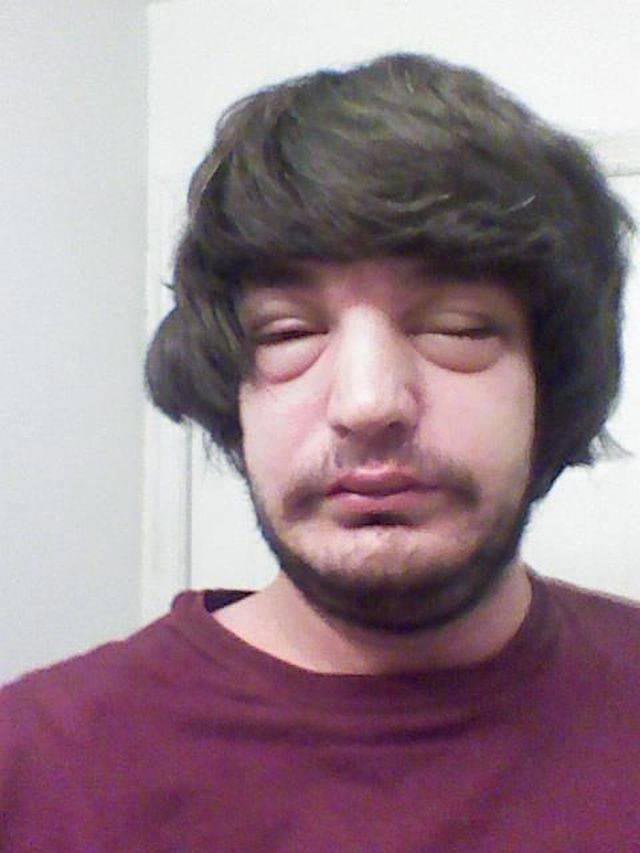 лица людей после аллергии, лица животных после аллергии, люди после аллергической реакции, животные после аллергической реакции