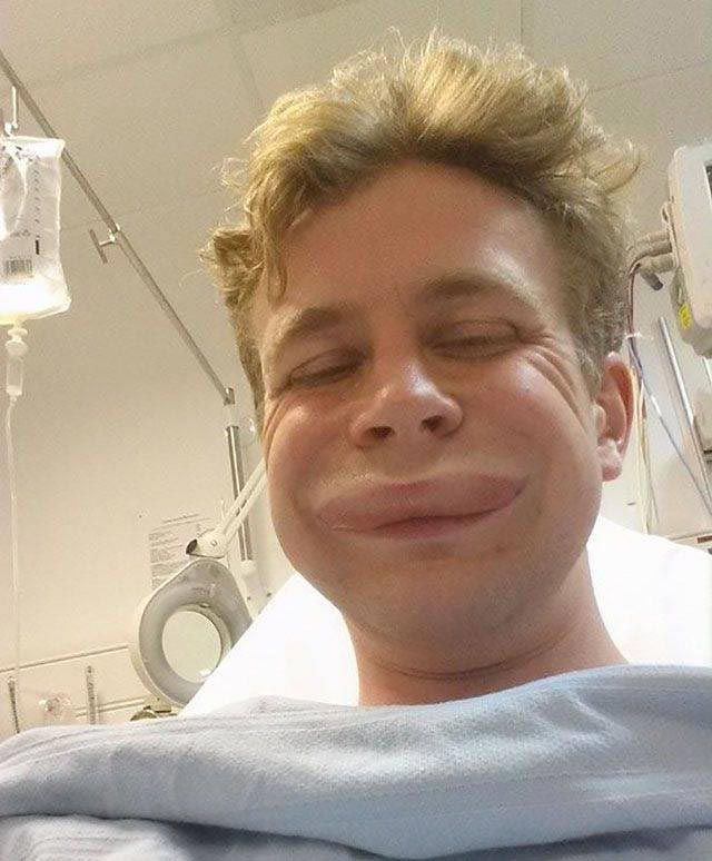 лица людей после аллергии, лица животных после аллергии, люди после аллергической реакции, животные после аллергической реакции