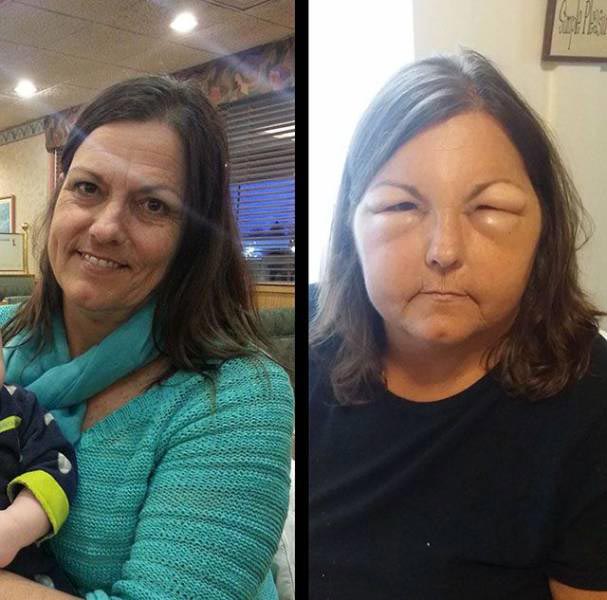 лица людей после аллергии, лица животных после аллергии, люди после аллергической реакции, животные после аллергической реакции