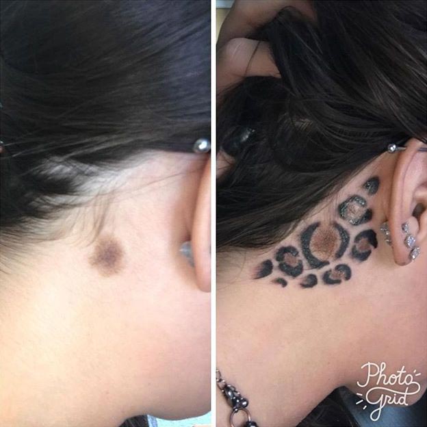 татуировка помогла перекрыть шрам и другие изъяны