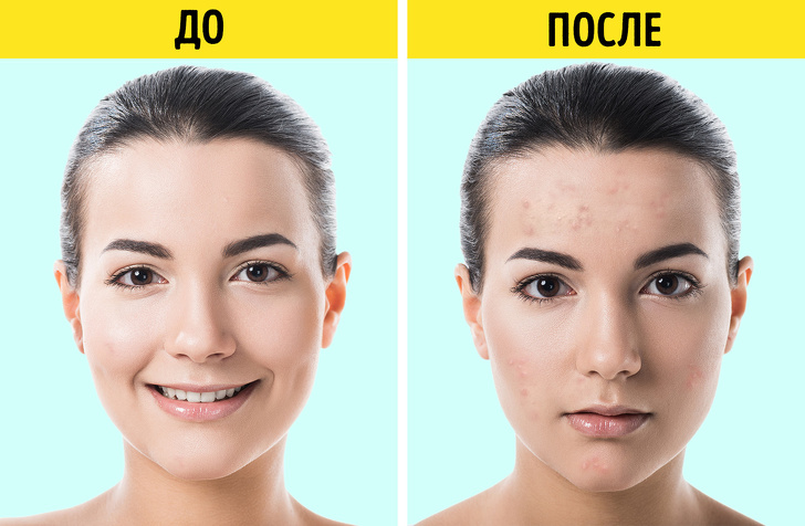 косметика которой не советуют пользоваться дерматологи, чёрный список дерматологов 