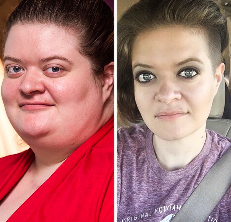 Надежда ермакова фото до и после операции