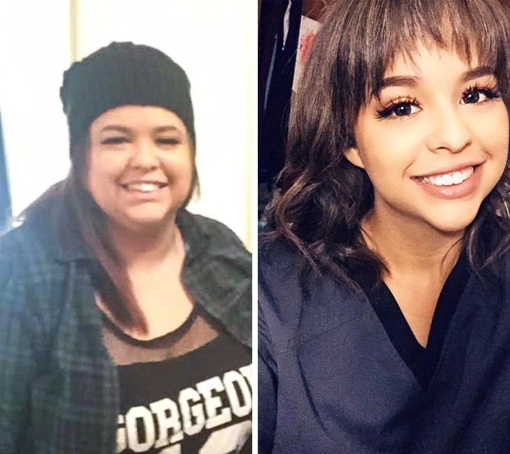 до и после похудения, невероятное похудение