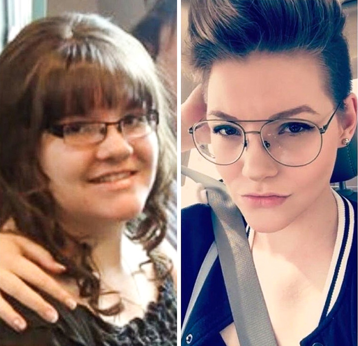 до и после похудения, невероятное похудение