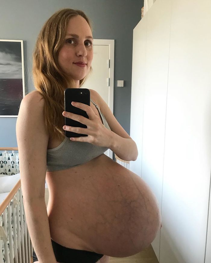 Как выглядит живот женщины беременной тройней, 36-летняя Мария беременна тр...