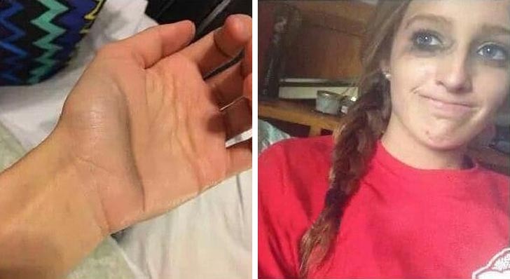 проблемы с которыми сталкивается каждая девушка, бьюти-проблемы 