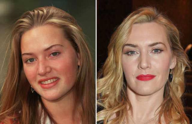 голливудские знаменитости тогда и сейчас, голливудские знаменитости в 2018 году, как изменились знаменитости 2018, знаменитости в молодости и в 2018