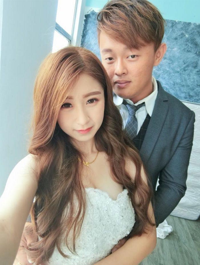 растяжки после беременности, глубокие растяжки после беременности, ужасные растяжки, растяжки на животе