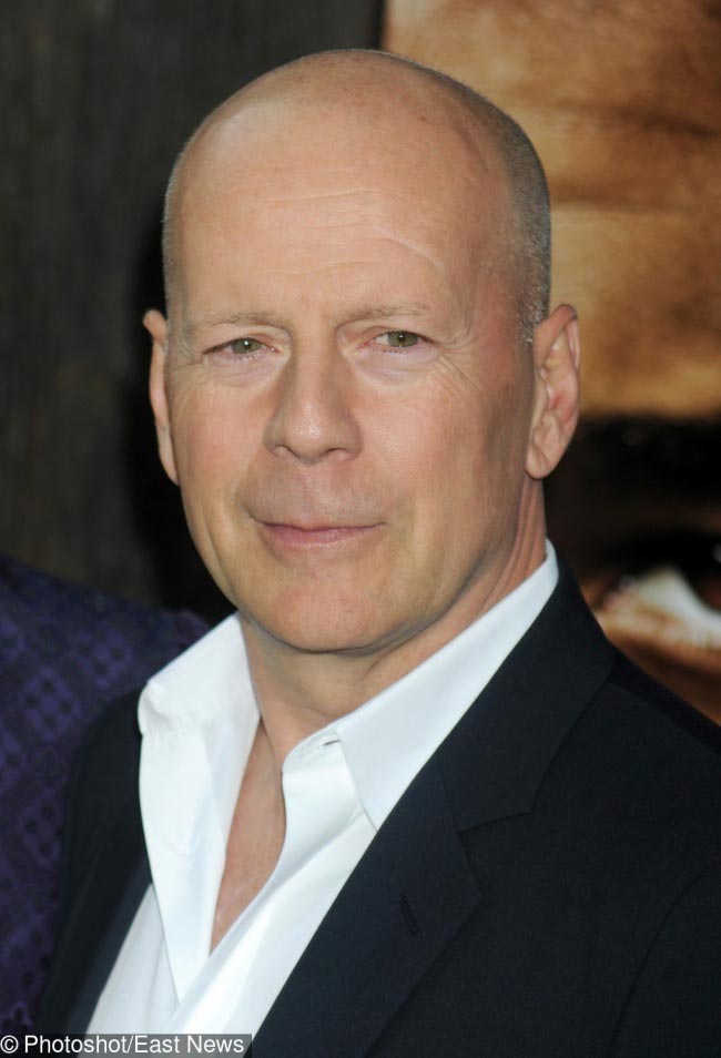 комплексы звёзд, что звёздам не нравится в своей внешности