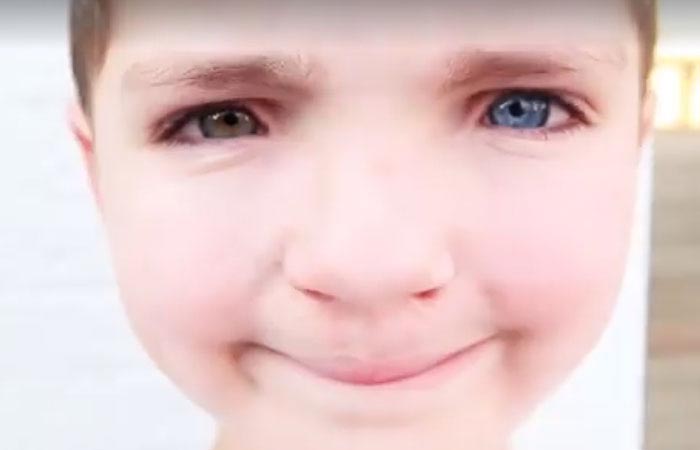 Мальчик нашёл кота с таким же редким состоянием глаз и заячьей губой, Мальчик нашёл кота с заячьей губой, Мэдден и Луна