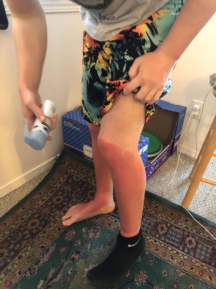 плохой день, неудачный день, если у вас был плохой день, фото плохой день