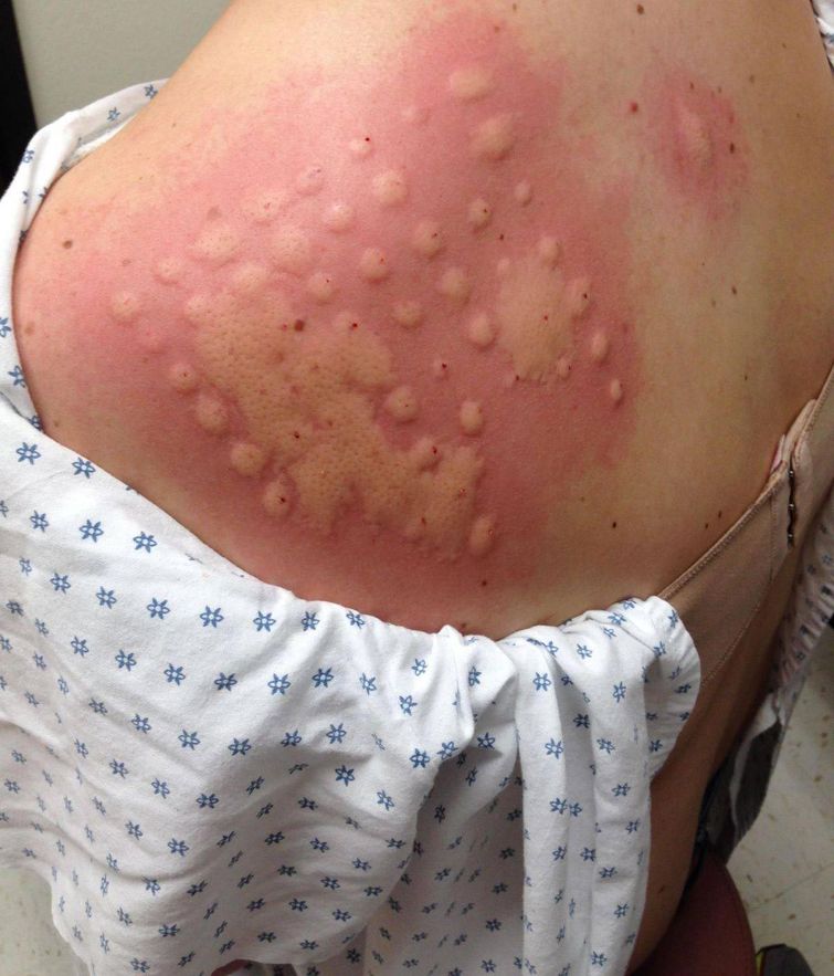 плохой день, неудачный день, если у вас был плохой день, фото плохой день