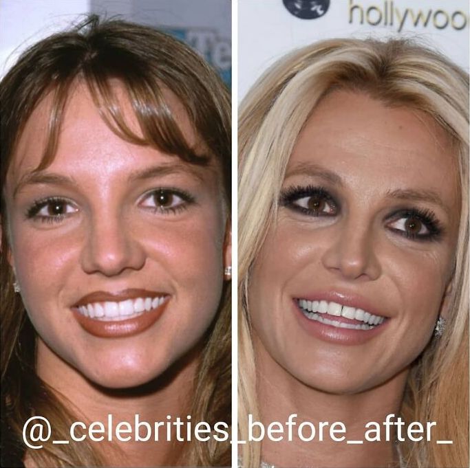 12-11-59-1639385979107666954