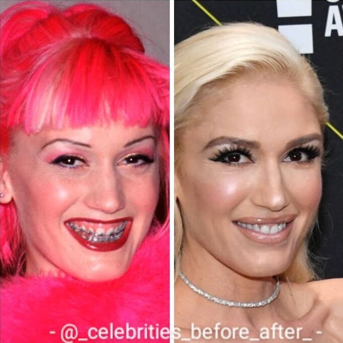 12-12-17-16393870501856393928