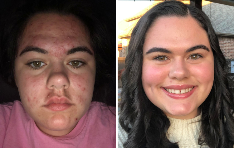 03-15-50-16473486031671661453