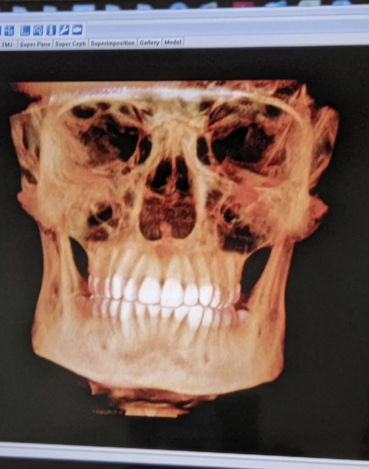 04-11-24-164975184751391022