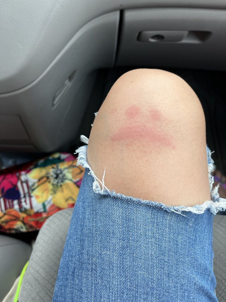 06-18-06-16559967691519762347