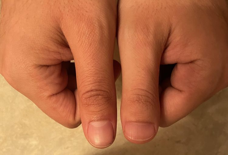 07-17-54-16590200922077407126