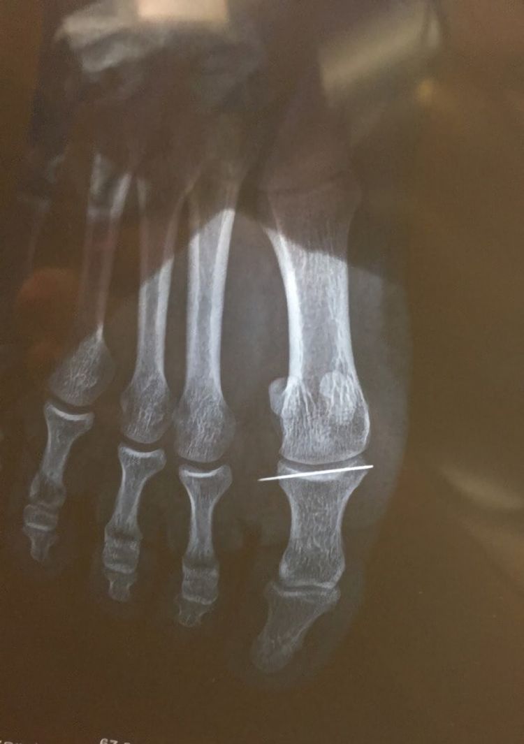 08-00-51-16593906791671122962