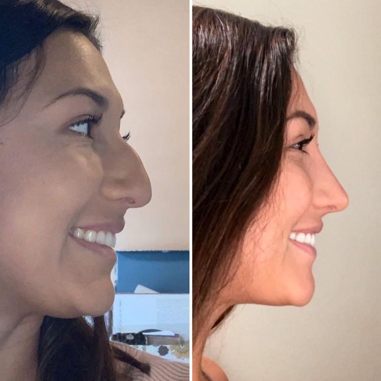 08-11-03-1660809812737357183