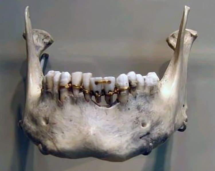 image-20220919221308-7