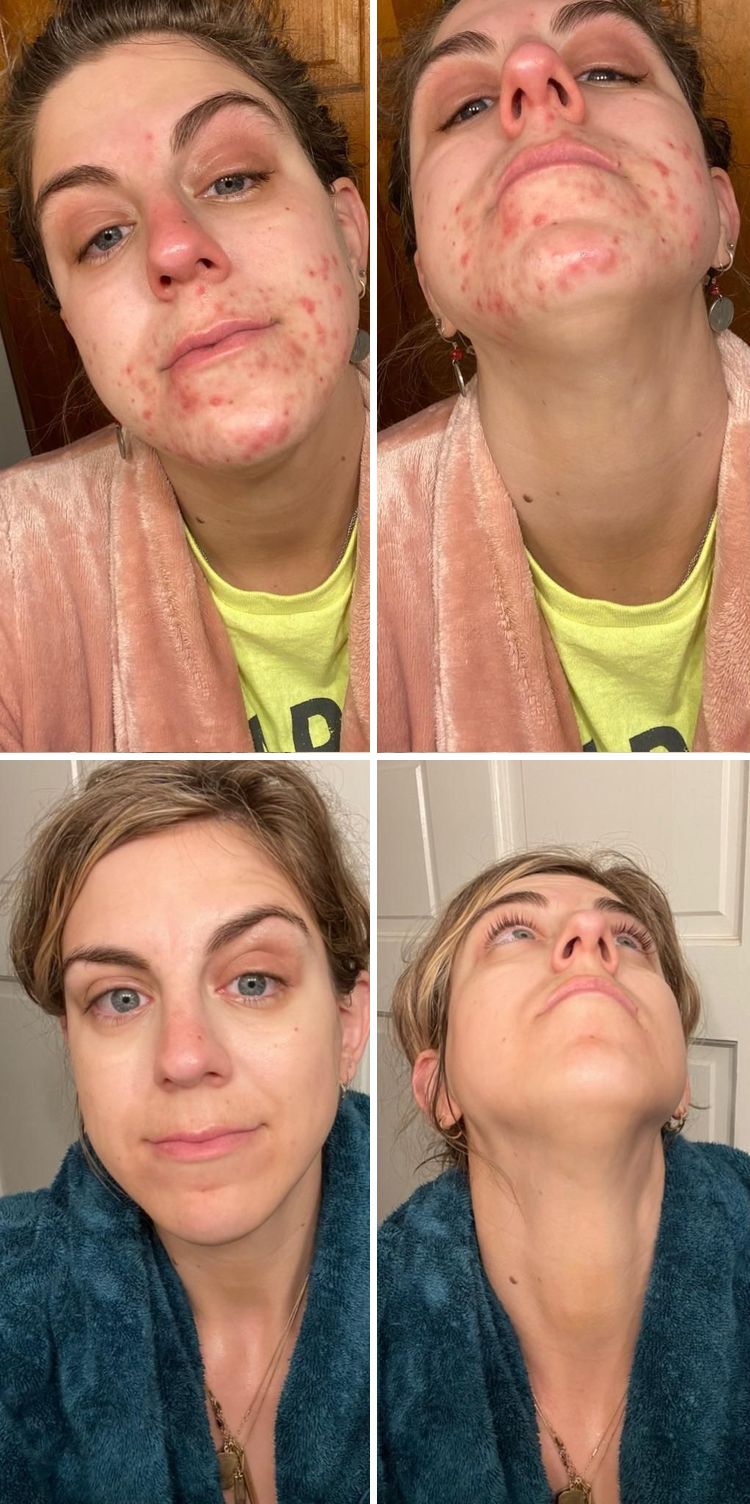 image-20221012172609-2