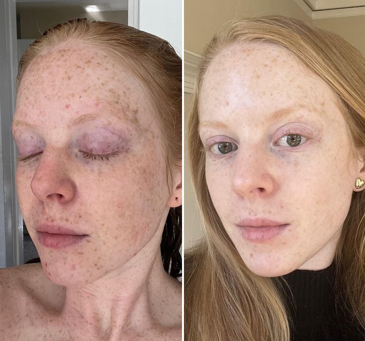 image-20221012172637-10