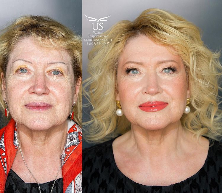 image-20221013123546-14